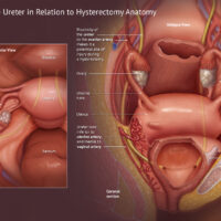 Burge Tonya Ureter Anat